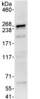 Immunoprecipitation - Anti-DLG5 antibody (AB86783)