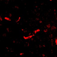 Immunocytochemistry/ Immunofluorescence - Anti-DLGAP2 antibody (AB106520), expandable thumbnail