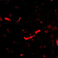 Immunocytochemistry/ Immunofluorescence - Anti-DLGAP2 antibody (AB106520)