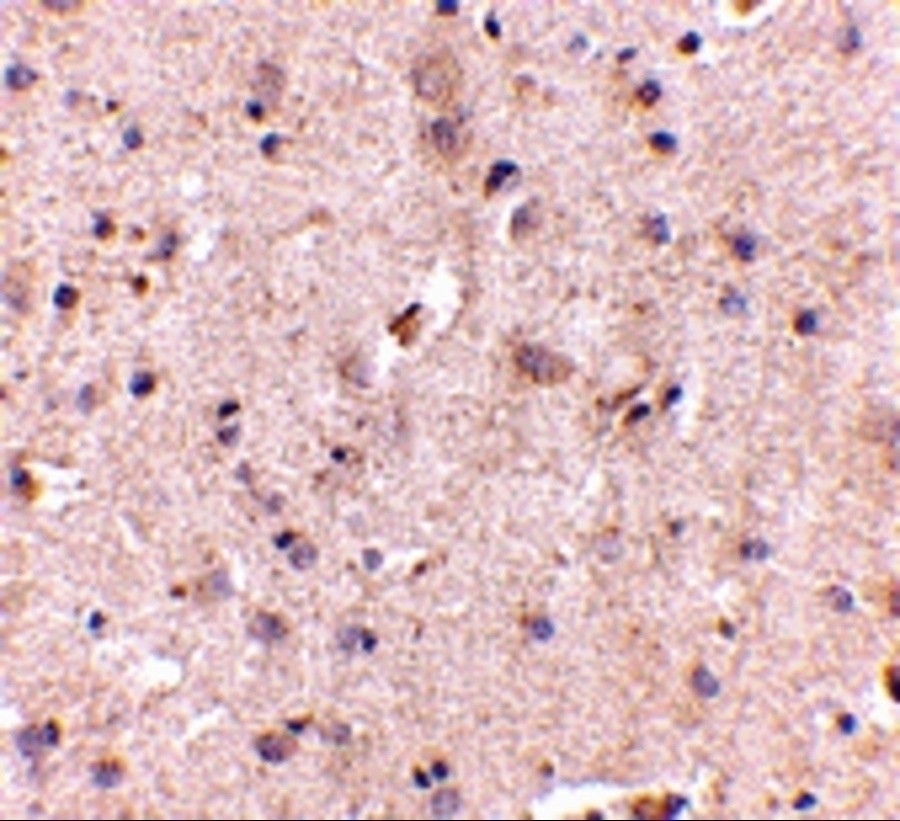 Immunohistochemistry (Formalin/PFA-fixed paraffin-embedded sections) - Anti-DLGAP2 antibody (AB106520), expandable thumbnail