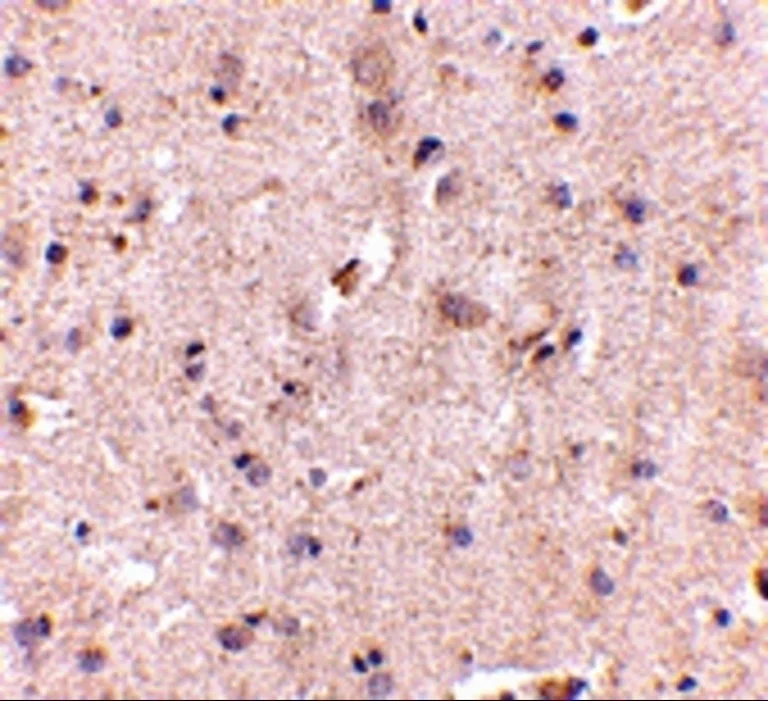 Immunohistochemistry (Formalin/PFA-fixed paraffin-embedded sections) - Anti-DLGAP2 antibody (AB106520)