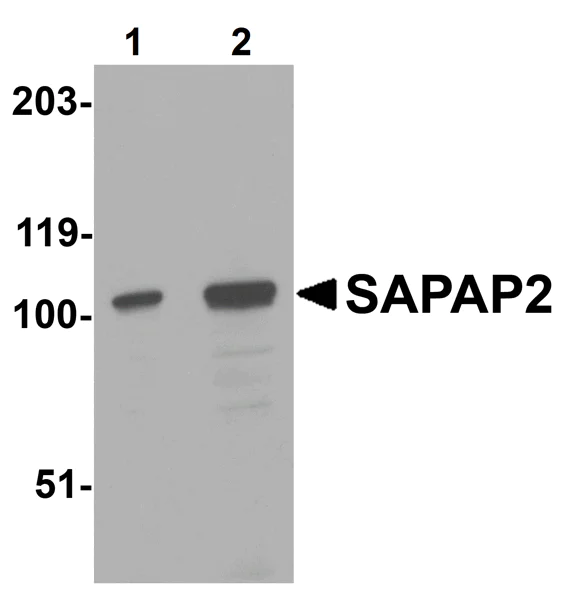 Western blot - Anti-DLGAP2 antibody (AB106520)