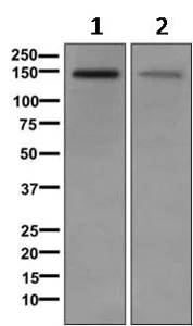 Western blot - Anti-DLGAP4 antibody [EPR10888] (AB168339)