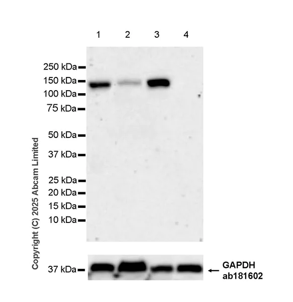 Western blot - Anti-DLGAP4 antibody [EPR29109-39] (AB324197)