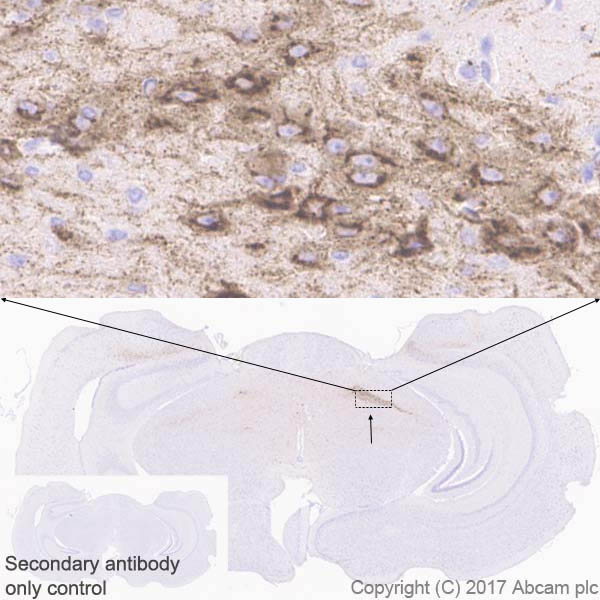 Immunohistochemistry (Formalin/PFA-fixed paraffin-embedded sections) - Anti-DLK-1 antibody [EPR19830] - BSA and Azide free (AB230380), expandable thumbnail