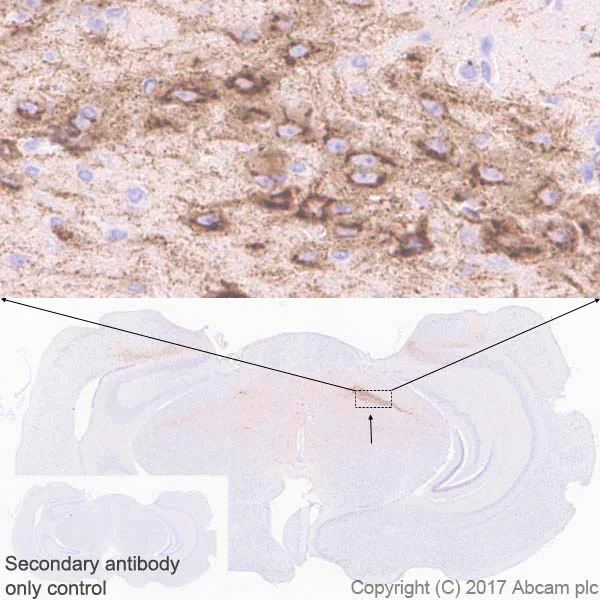 Immunohistochemistry (Formalin/PFA-fixed paraffin-embedded sections) - Anti-DLK-1 antibody [EPR19830] - BSA and Azide free (AB230380)