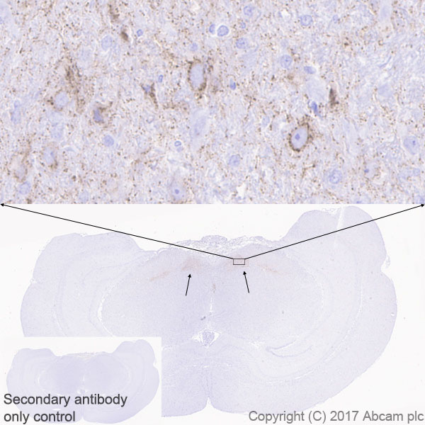 Immunohistochemistry (Formalin/PFA-fixed paraffin-embedded sections) - Anti-DLK-1 antibody [EPR19830] - BSA and Azide free (AB230380), expandable thumbnail