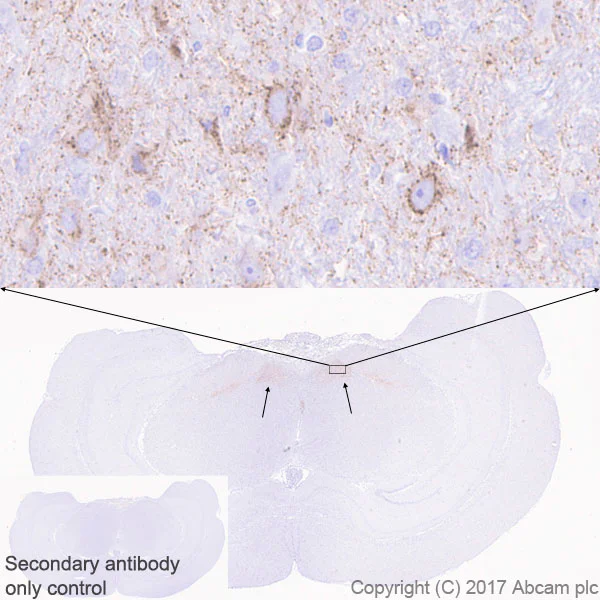Immunohistochemistry (Formalin/PFA-fixed paraffin-embedded sections) - Anti-DLK-1 antibody [EPR19830] - BSA and Azide free (AB230380)