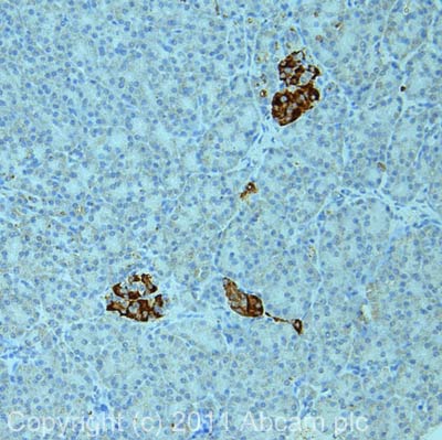 Immunohistochemistry (Formalin/PFA-fixed paraffin-embedded sections) - Anti-DLK-1 antibody [MM0514-9D8] (AB89908), expandable thumbnail