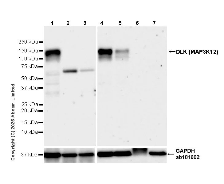 Western blot - Anti-DLK (MAP3K12) antibody [EPR30420-541] (AB325176)