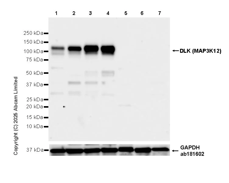 Western blot - Anti-DLK (MAP3K12) antibody [EPR30420-541] (AB325176)