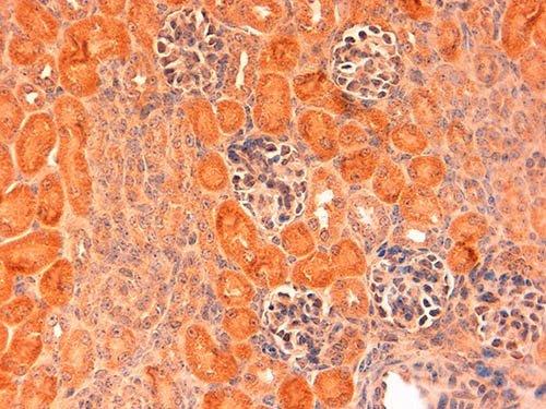 Immunohistochemistry (Formalin/PFA-fixed paraffin-embedded sections) - Anti-DLL1 antibody (AB10554), expandable thumbnail