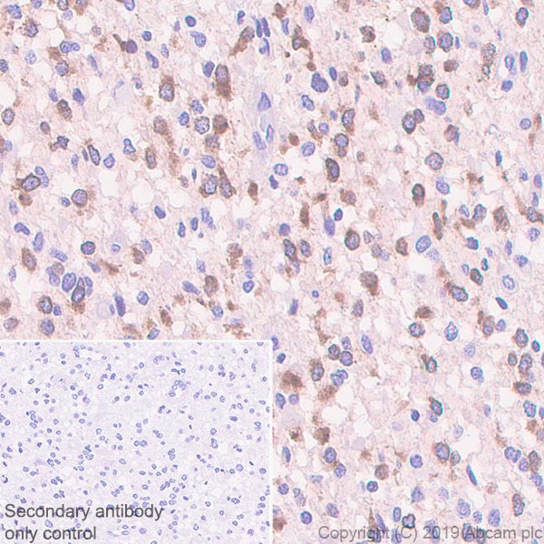 Immunohistochemistry (Formalin/PFA-fixed paraffin-embedded sections) - Anti-DLL3 antibody [EPR22592-18] - BSA and Azide free (AB255694), expandable thumbnail