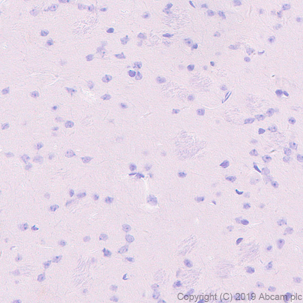 Immunohistochemistry (Formalin/PFA-fixed paraffin-embedded sections) - Anti-DLL3 antibody [EPR22592-18] - BSA and Azide free (AB255694), expandable thumbnail