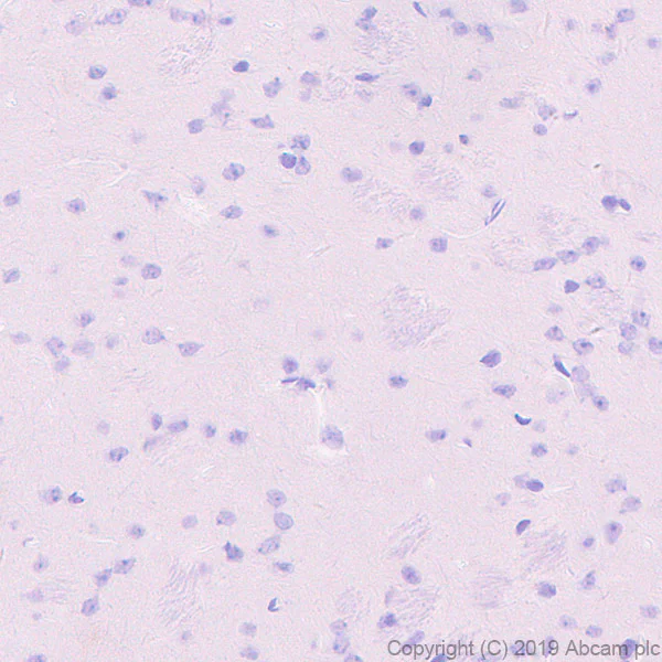 Immunohistochemistry (Formalin/PFA-fixed paraffin-embedded sections) - Anti-DLL3 antibody [EPR22592-18] - BSA and Azide free (AB255694)
