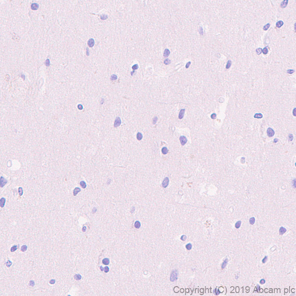 Immunohistochemistry (Formalin/PFA-fixed paraffin-embedded sections) - Anti-DLL3 antibody [EPR22592-18] - BSA and Azide free (AB255694), expandable thumbnail