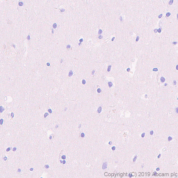 Immunohistochemistry (Formalin/PFA-fixed paraffin-embedded sections) - Anti-DLL3 antibody [EPR22592-18] - BSA and Azide free (AB255694)