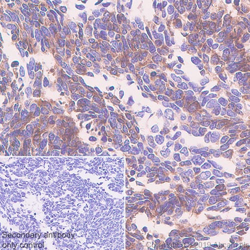 Immunohistochemistry (Formalin/PFA-fixed paraffin-embedded sections) - Anti-DLL3 antibody [EPR22592-18] - BSA and Azide free (AB255694), expandable thumbnail