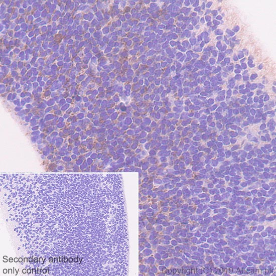 Immunohistochemistry (Formalin/PFA-fixed paraffin-embedded sections) - Anti-DLL3 antibody [EPR22592-18] - BSA and Azide free (AB255694), expandable thumbnail