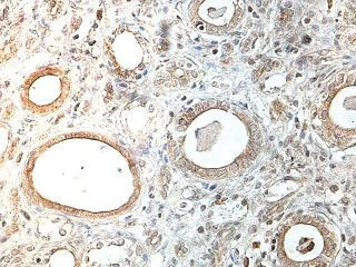 Immunohistochemistry (Formalin/PFA-fixed paraffin-embedded sections) - Anti-DLL4 antibody (AB176876)