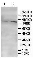 Western blot - Anti-DLL4 antibody (AB176876), expandable thumbnail