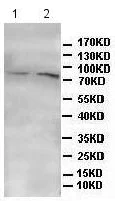 Western blot - Anti-DLL4 antibody (AB176876)