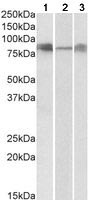 Western blot - Anti-DLL4 antibody (AB183532), expandable thumbnail