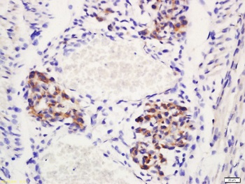 Immunohistochemistry (Formalin/PFA-fixed paraffin-embedded sections) - Anti-DLL4 antibody (AB217860), expandable thumbnail