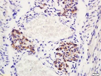 Immunohistochemistry (Formalin/PFA-fixed paraffin-embedded sections) - Anti-DLL4 antibody (AB217860)