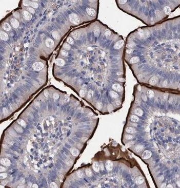 Immunohistochemistry (Formalin/PFA-fixed paraffin-embedded sections) - Anti-DLL4 antibody (AB223732), expandable thumbnail