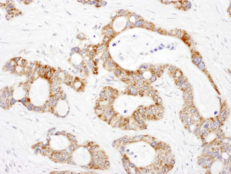 Immunohistochemistry (Formalin/PFA-fixed paraffin-embedded sections) - Anti-DLST antibody (AB187699)