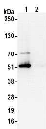 Immunoprecipitation - Anti-DLST antibody (AB187699), expandable thumbnail