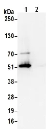 Immunoprecipitation - Anti-DLST antibody (AB187699)