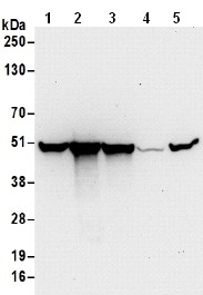 Western blot - Anti-DLST antibody (AB187699), expandable thumbnail
