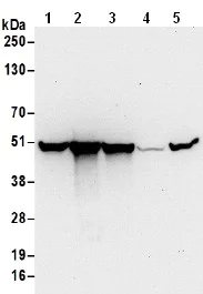 Western blot - Anti-DLST antibody (AB187699)