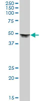 Western blot - Anti-DLST antibody (AB72790)