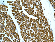 Immunohistochemistry (Formalin/PFA-fixed paraffin-embedded sections) - Anti-DLST antibody [EPR13318(B)] (AB177934)