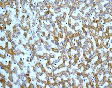 Immunohistochemistry (Formalin/PFA-fixed paraffin-embedded sections) - Anti-DLST antibody [EPR13318(B)] - BSA and Azide free (AB250009)