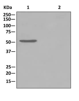 Immunoprecipitation - Anti-DLST antibody [EPR13318(B)] - BSA and Azide free (AB250009)
