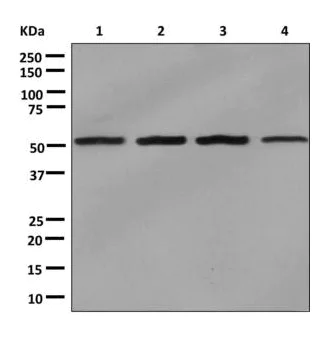Western blot - Anti-DLST antibody [EPR13318(B)] - BSA and Azide free (AB250009)