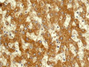 Immunohistochemistry (Formalin/PFA-fixed paraffin-embedded sections) - Anti-DLST antibody [EPR13319(B)] (AB178692)