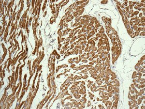 Immunohistochemistry (Formalin/PFA-fixed paraffin-embedded sections) - Anti-DLST antibody [EPR13319(B)] (AB178692)