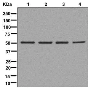 Western blot - Anti-DLST antibody [EPR13319(B)] - BSA and Azide free (AB250066)