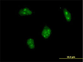 Immunocytochemistry/ Immunofluorescence - Anti-Dlx1 antibody (AB167575), expandable thumbnail
