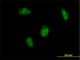 Immunocytochemistry/ Immunofluorescence - Anti-Dlx1 antibody (AB167575)