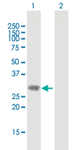 Western blot - Anti-Dlx1 antibody (AB167575), expandable thumbnail