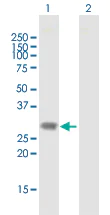 Western blot - Anti-Dlx1 antibody (AB167575)