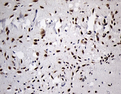 Immunohistochemistry (Formalin/PFA-fixed paraffin-embedded sections) - Anti-Dlx1 antibody [OTI1E6] (AB236381)