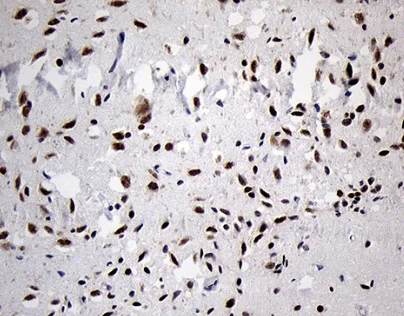 Immunohistochemistry (Formalin/PFA-fixed paraffin-embedded sections) - Anti-Dlx1 antibody [OTI1E6] (AB236381)