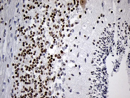 Immunohistochemistry (Formalin/PFA-fixed paraffin-embedded sections) - Anti-Dlx1 antibody [OTI1E6] (AB236381)